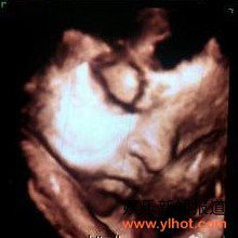 陈浩民女儿的B超照