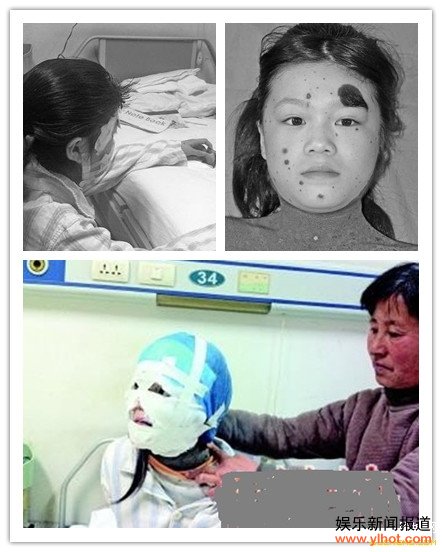 ����12��Ů��ȫ����������Ƥ�� ������沿����