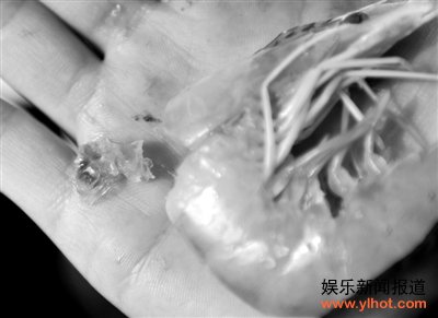 “注胶虾”横行津门 责任不明无人监管